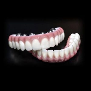 permanent denture alternative Lake Havasu City