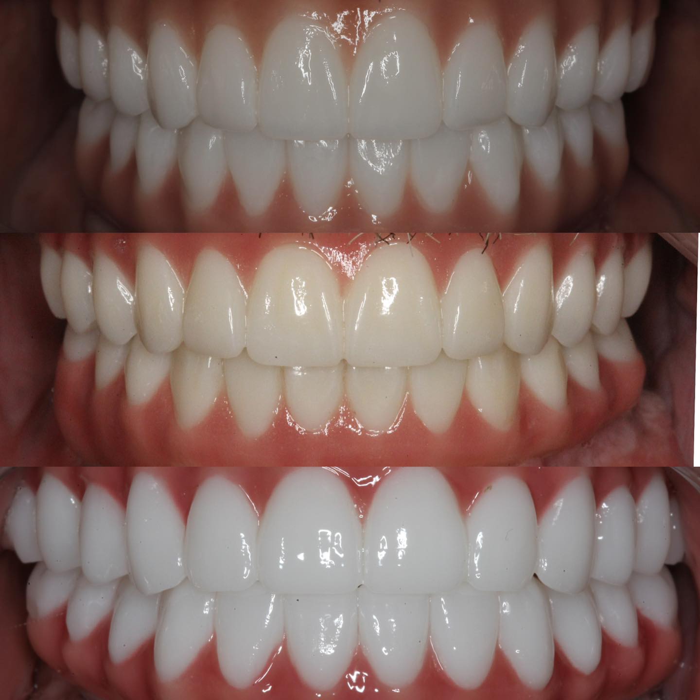 missing teeth solutions Lake Havasu, replace missing teeth permanently, modern tooth replacement options, fixed dental solutions