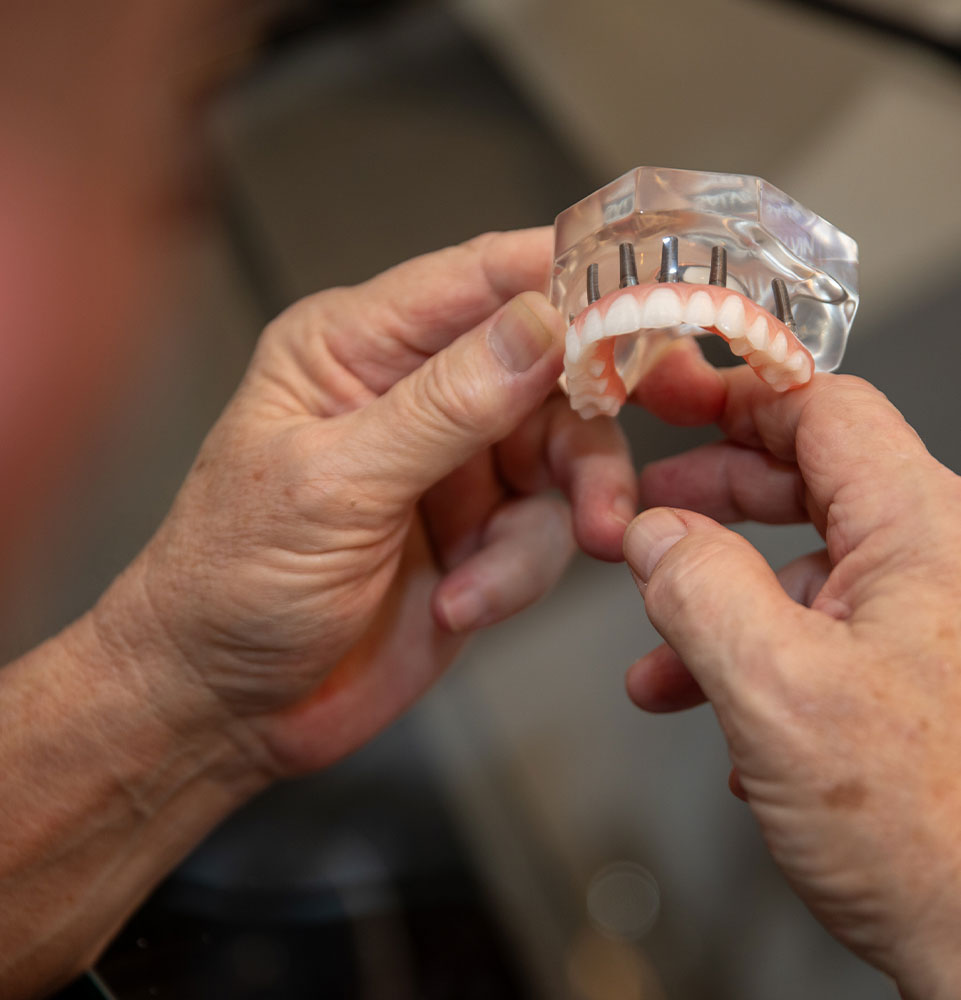 Close-up of hands holding a dental model showing a full arch of teeth supported by implants.